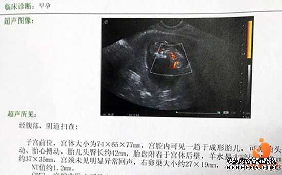 虎泉捐卵_【昆明市昆华医院供卵吗】分享我的试管婴儿的费用以及流程